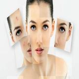 Get Rid of Acne Zeichen