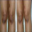 How to bleach your knee  (Guid