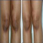 How to bleach your knee  (Guid icon