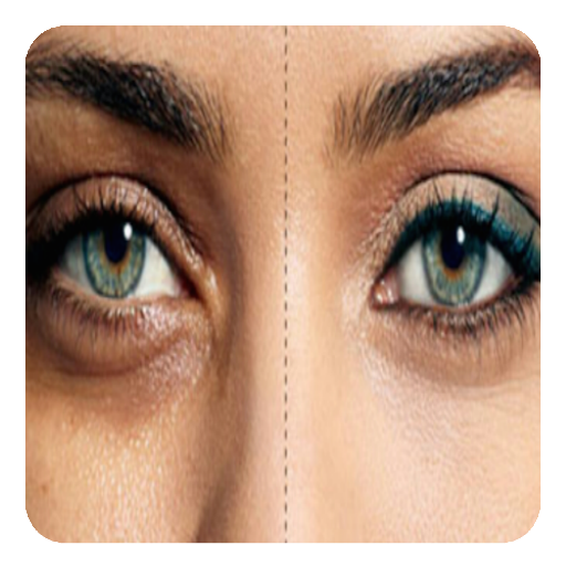 how to remove dark circles  (G