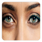 how to remove dark circles  (G Zeichen