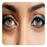 how to remove dark circles  (G Zeichen