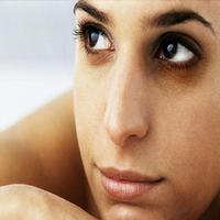 how to remove dark circles  (G Screenshot 1
