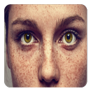 How to get ride of Freckles  ( APK