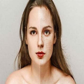 Free Roblox Faces Freckles