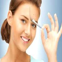 Get Rid of Acne ảnh chụp màn hình 1
