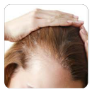 Baldness Guide APK