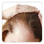 Baldness biểu tượng