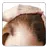 Baldness Guide APK