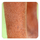 Xerosis (Guide) APK