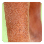 Xerosis biểu tượng