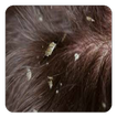Dry Scalp Guide