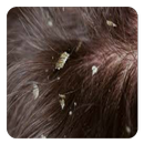 Dry Scalp Guide APK
