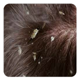 Dry Scalp biểu tượng