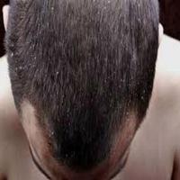 Dry Scalp ảnh chụp màn hình 1