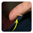 Remove a Splinter Safely (Guide) APK