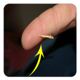 Remove a Splinter Safely biểu tượng