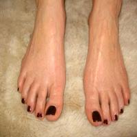 Sweaty Palms and Feet bài đăng