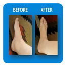 Swollen Feet (Guide) APK