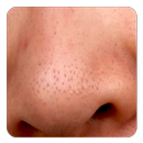 Blackheads Guide APK