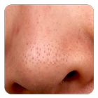 Blackheads biểu tượng
