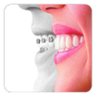 Orthodontic (Guide)
