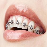 Orthodontic bài đăng