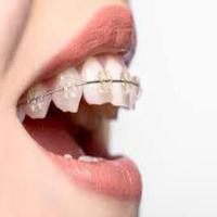 Orthodontic ảnh chụp màn hình 1