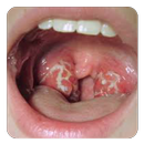 Sore Throat in Children (Guide) APK