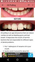 Tooth Decay& Cavities Remedies скриншот 1