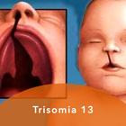 Trisomia 13 ikon