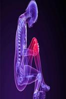 Knees therapy স্ক্রিনশট 1