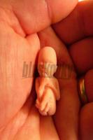 پوستر Abortion