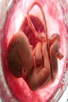 Abortion imagem de tela 1