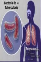 tuberculosis اسکرین شاٹ 1