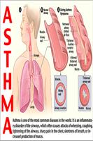 Asthma screenshot 3