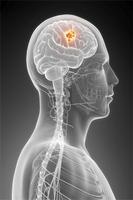 Glioblastoma โปสเตอร์