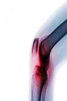 Rheumatism স্ক্রিনশট 1