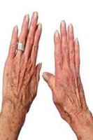 Rheumatism স্ক্রিনশট 2