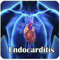 Endokarditis