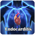 Icona L'endocardite
