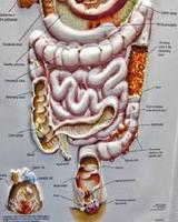 Coloscopy پوسٹر