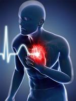 symptômes d'une crise cardiaque Affiche