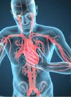 Angina poster