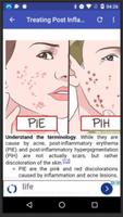 Get Rid of Acne Scars screenshot 3