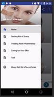Get Rid of Acne Scars poster