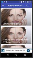 Get Rid of Acne Scars screenshot 1