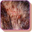 Best way to treat your Head Scalp scrabs APK