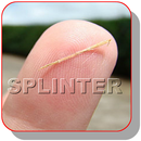APK How to remove splinter safely at Home