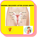 How to Recover your Vaginal size after Birth aplikacja